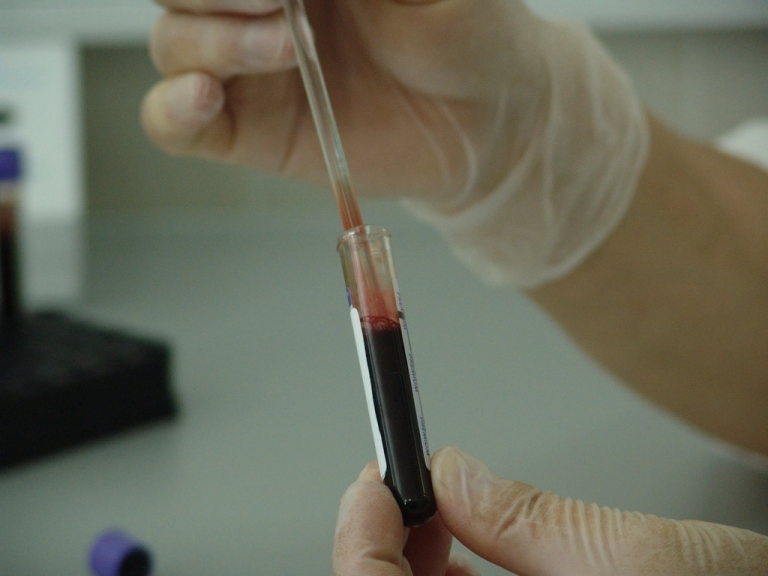 Gloved hand holding a blood sample tube