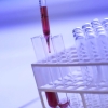 Blood sample tubes in a lab rack for hormone testing
