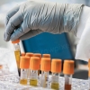 Laboratory technician handling blood sample tubes