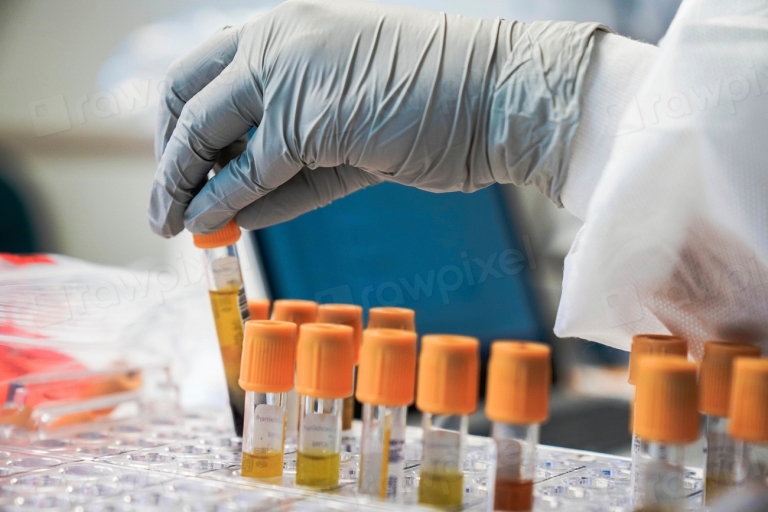 Laboratory technician handling blood sample tubes